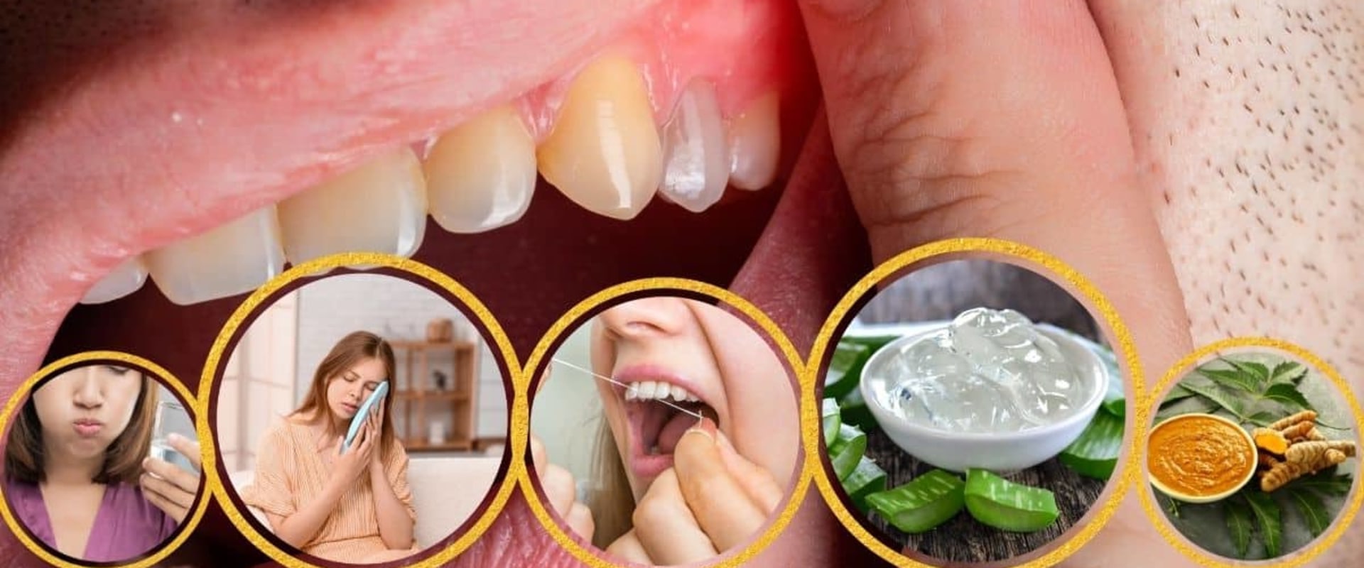 The Power of Aloe Vera for Receding Gums