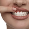 The Power of Aloe Vera Mouthwash for Receding Gums