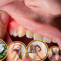 The Power of Aloe Vera for Receding Gums