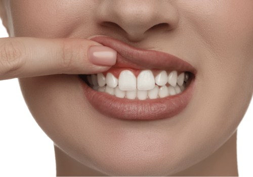 The Healing Power of Acupuncture for Receding Gums