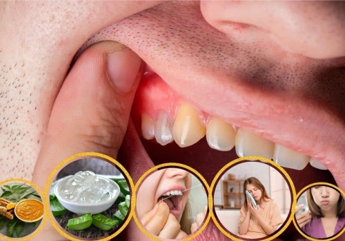 The Power of Aloe Vera for Receding Gums